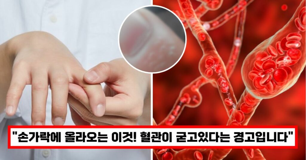 손가락으로 알수있는 혈관의 경고
