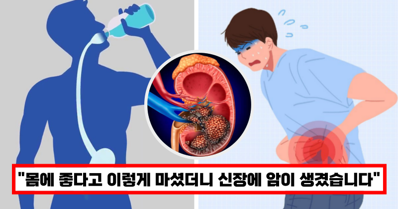 신장에 암생기는 물 마시기 습관